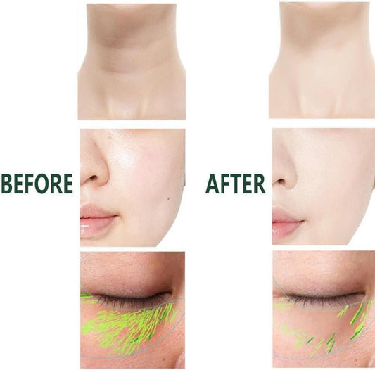 Get Free with wrinkle with Advance face technology of 2 In 1 Anti Wrinkle  Device